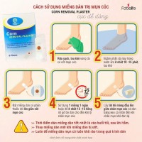 Miếng Dán Mụn Cóc Mụn Cơm Corn plaster KangDi Fobe - hộp 6 miếng