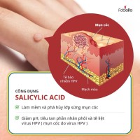 Miếng Dán Mụn Cóc Mụn Cơm Corn plaster KangDi Fobe - hộp 6 miếng