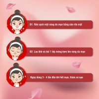 Kem Ngừa Mụn ACNEVIR SANTAFA Giảm Mụn Đầu Đen Mụn Cám - Tuýp 15gr