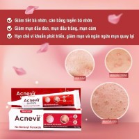 Kem Ngừa Mụn ACNEVIR SANTAFA Giảm Mụn Đầu Đen Mụn Cám - Tuýp 15gr