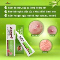 Kem Giảm Mụn Mủ, Mụn Bọc, Mụn Đỏ Và Mụn Trứng Cá Acnevir Santafa - Tuýp 10gr
